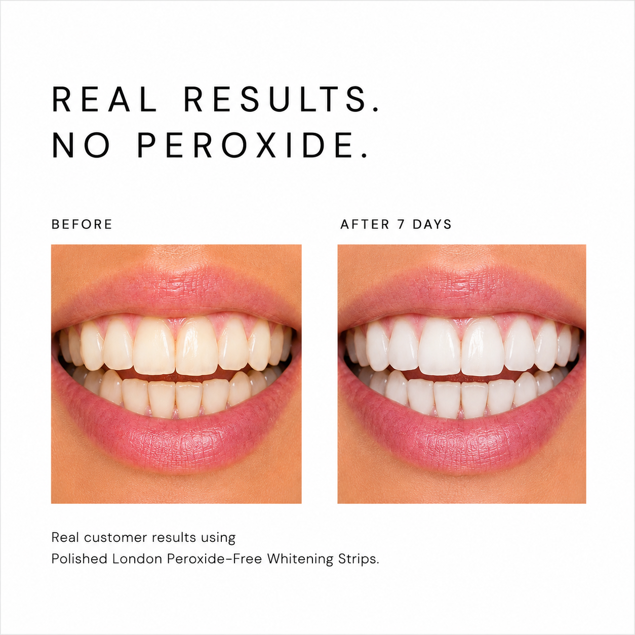 Advanced Teeth Whitening Strips