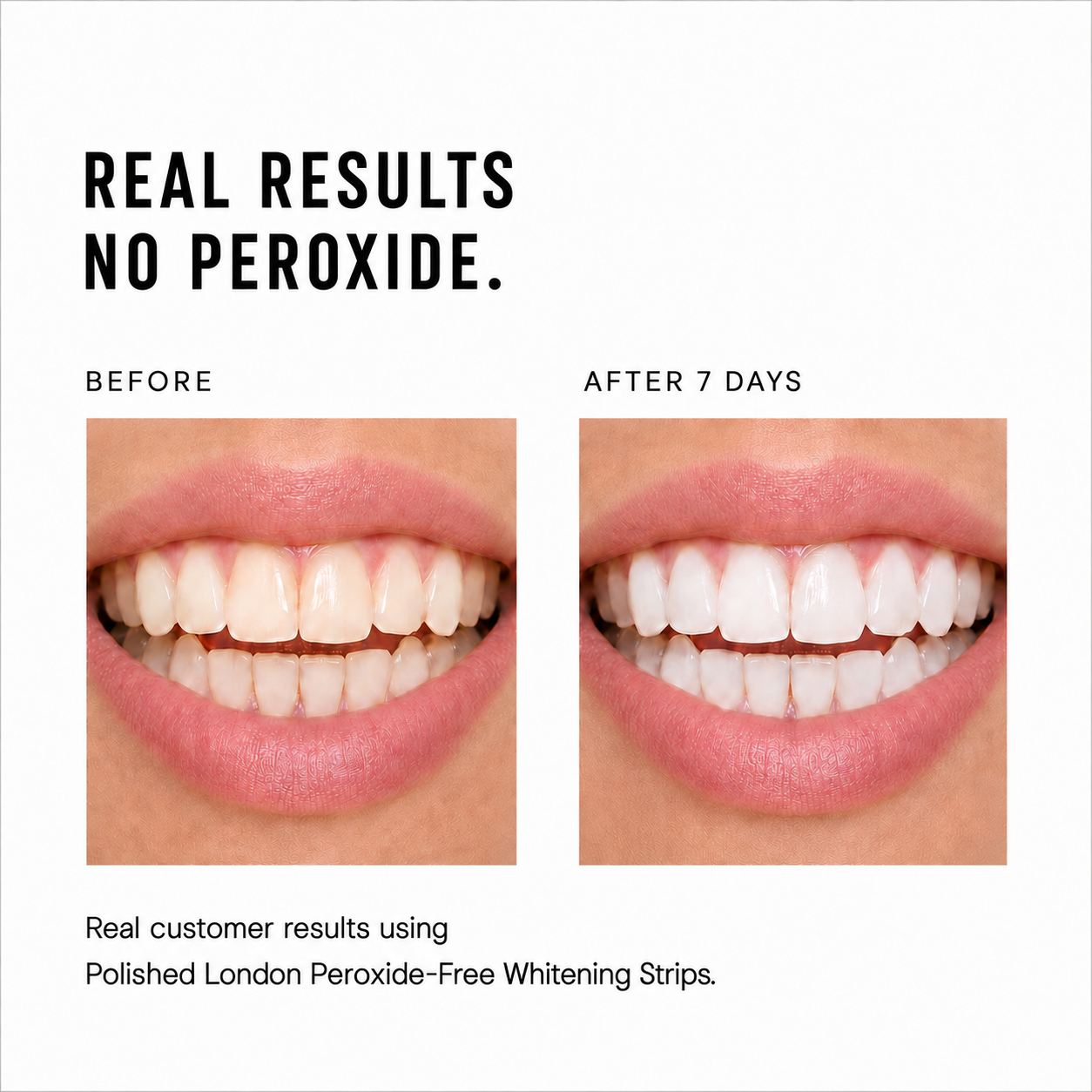 Advanced Teeth Whitening Strips