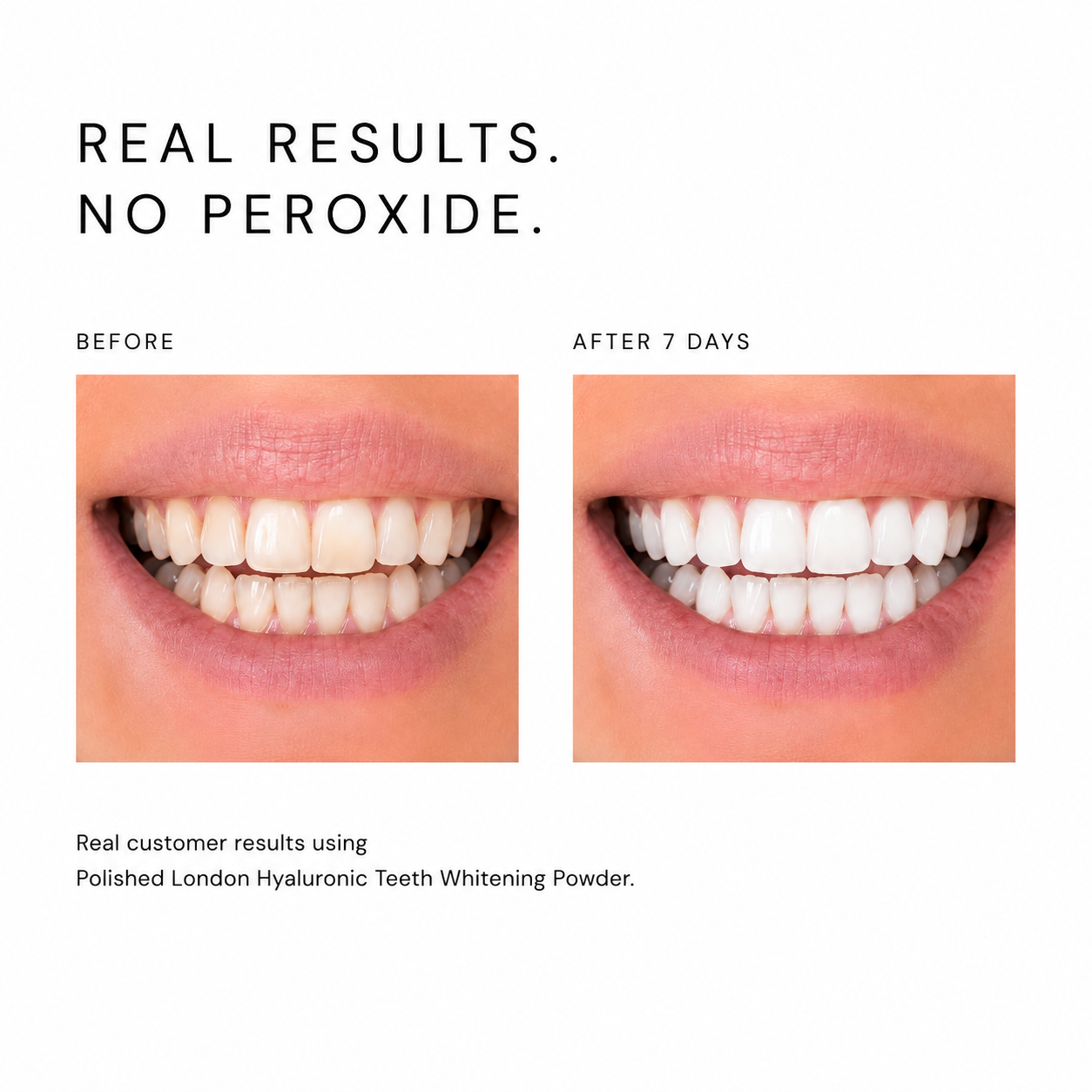 Advanced Hyaluronic Teeth Whitening Powder