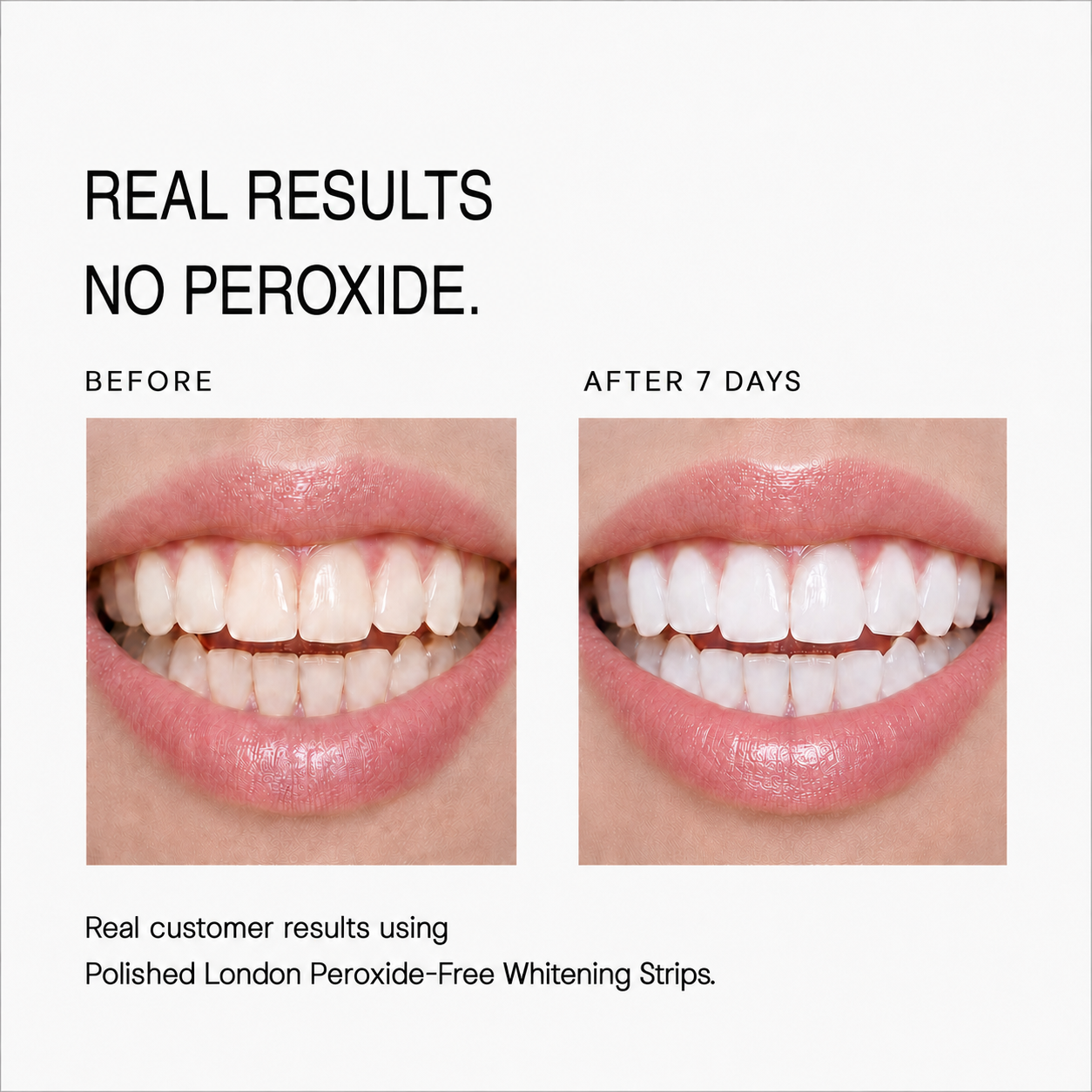 Advanced Teeth Whitening Powder