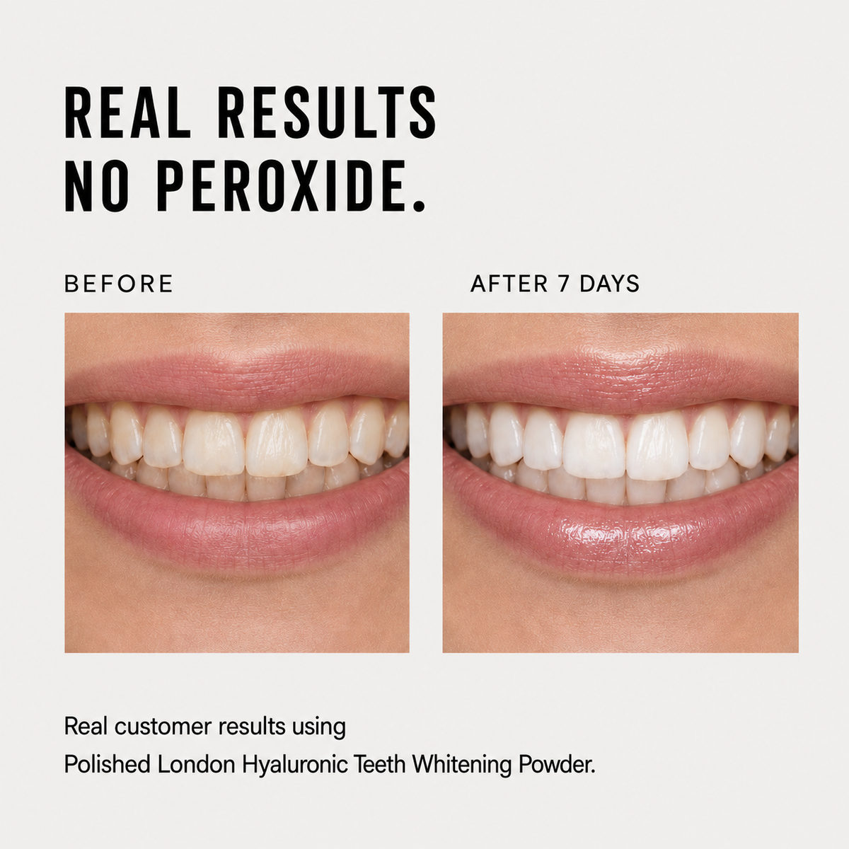 Hyaluronic Teeth Whitening Powder